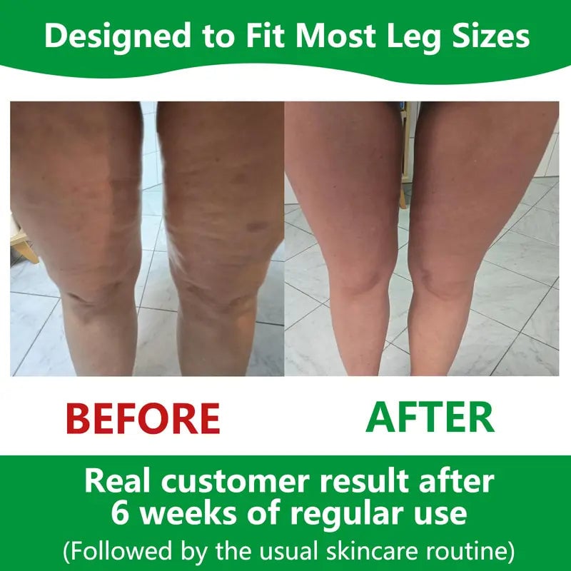 Anti-Cellulite Massage Roller