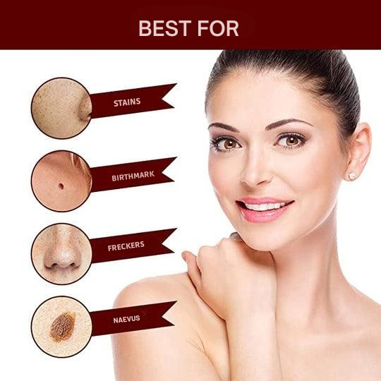 Wart Removal | Precision Applicator for Targeted Treatment | Plant-Based Care Formula