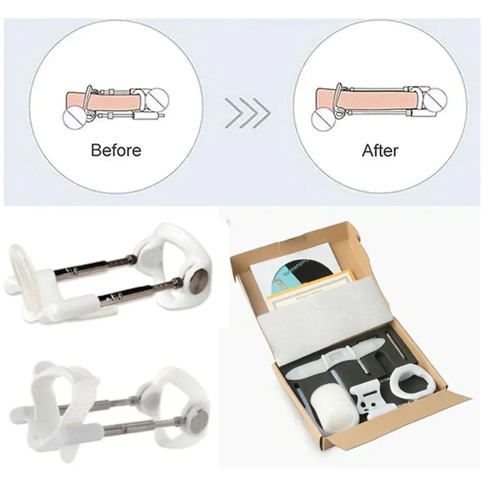 Adjustable Physical Traction Device for Gentle Support