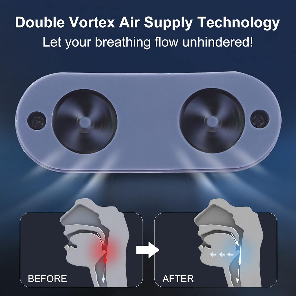 Anti-Snoring Micro CPAP Device
