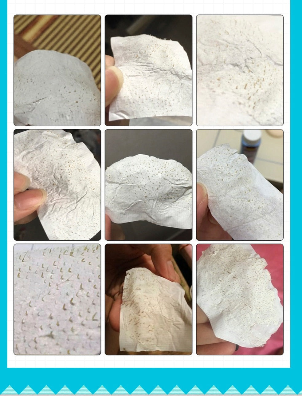 Blackhead Remover Strips