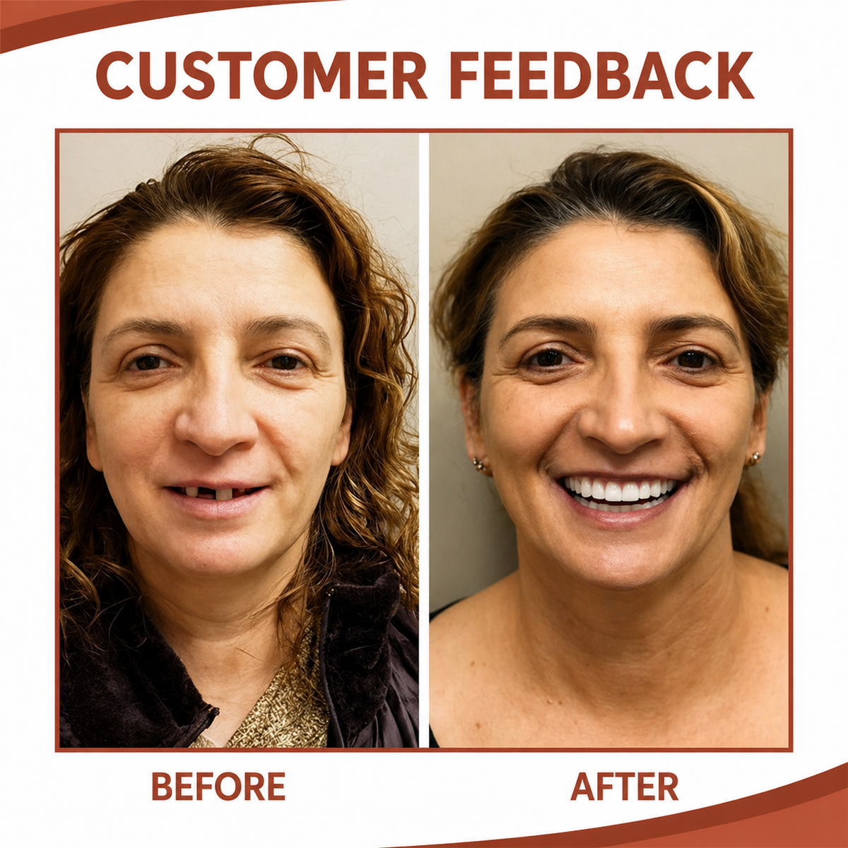 Dental Prosthesis with Soft Silicone Cushion - Non-Slip Fit Without Pressure Points