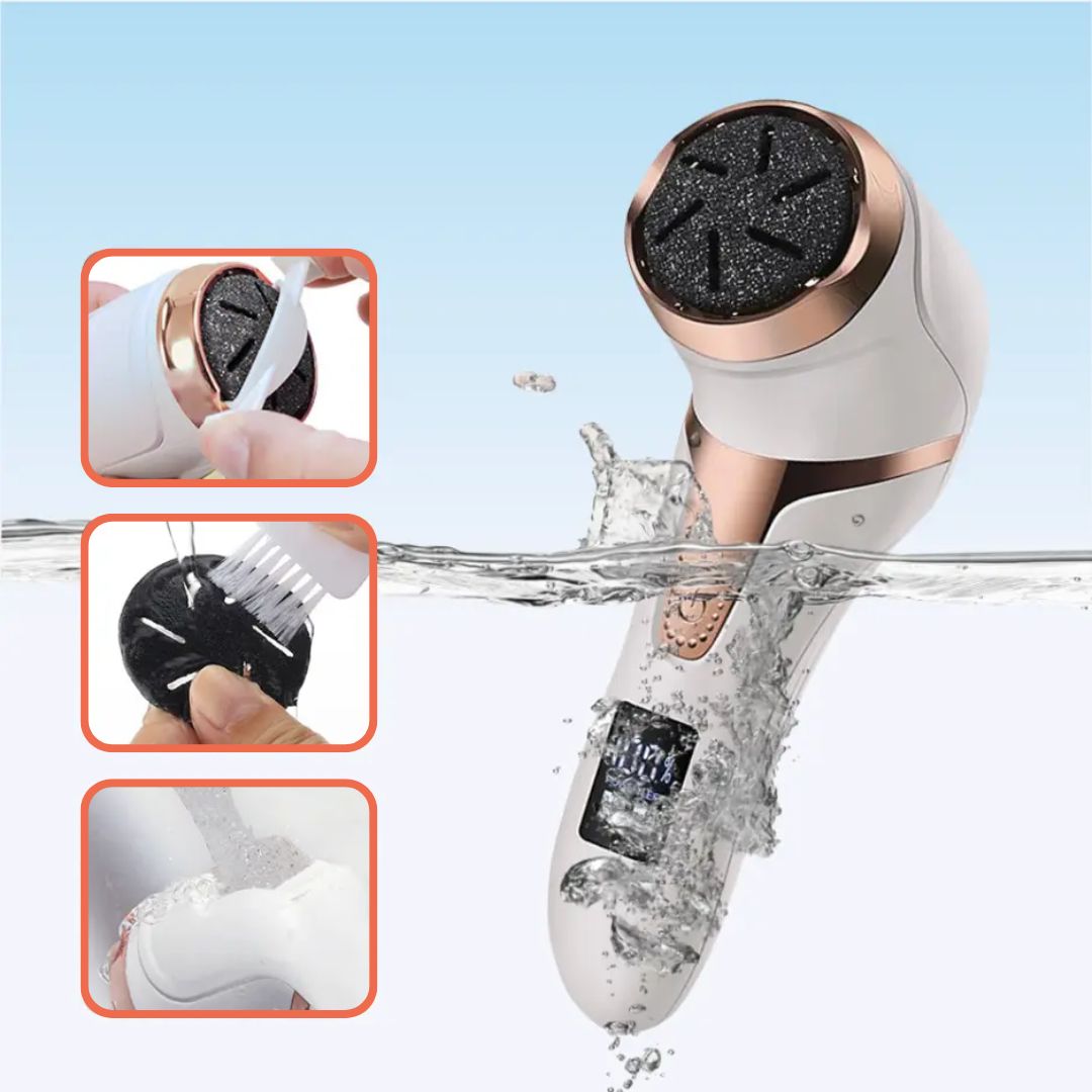 Electric Callus and Corn Remover Device