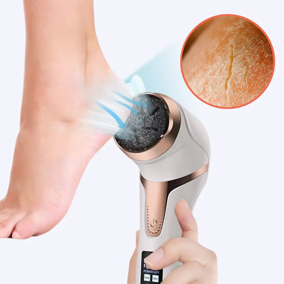 Electric Callus and Corn Remover Device