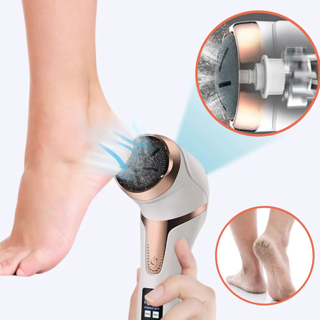Electric Callus and Corn Remover Device