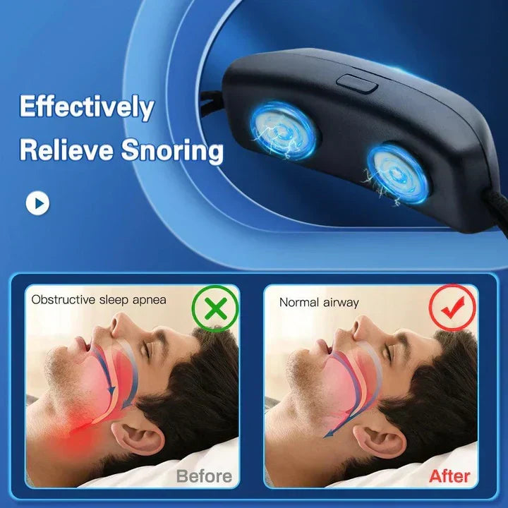 EMS Pulse Anti-Snoring Device - Wearable Sleep Aid