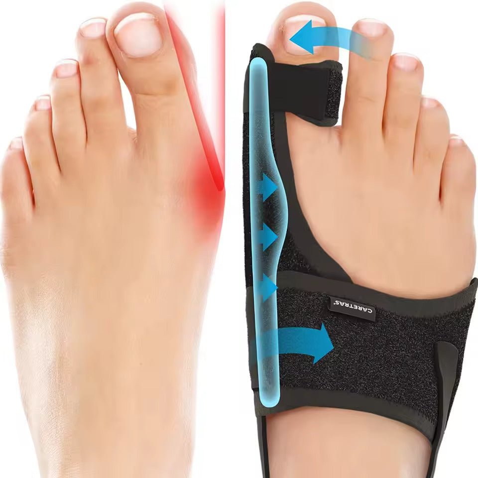 Ergonomic and Adjustable Comfortable Hallux Valgus Night Splint