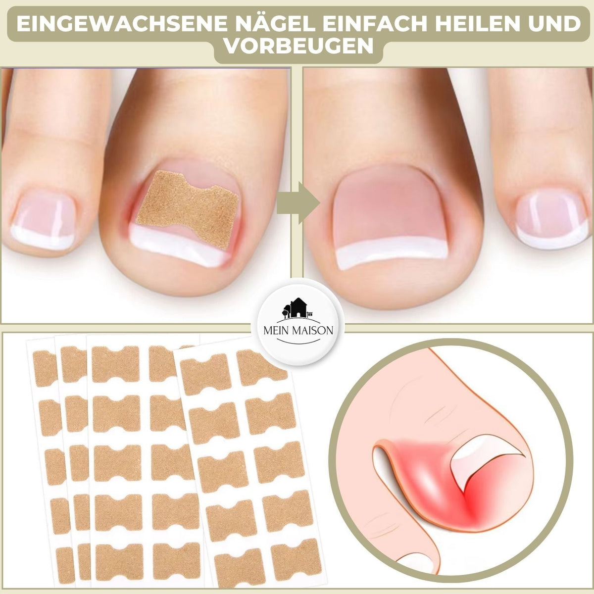 Instant Nail Repair Strips