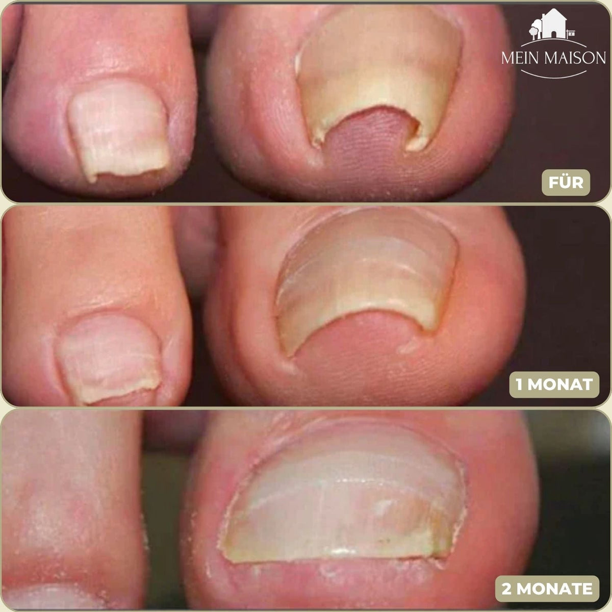 Instant Nail Repair Strips