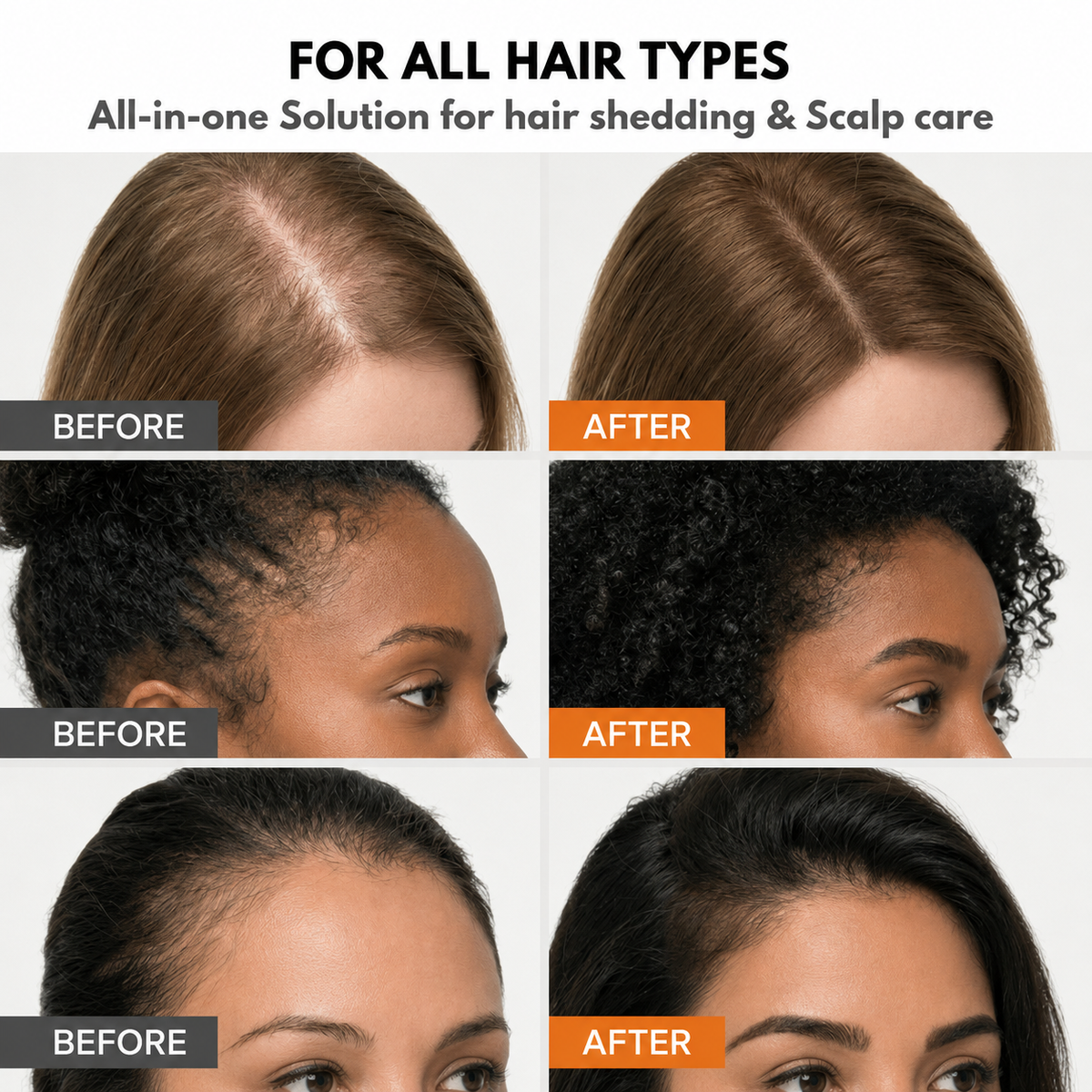 Korean Hair Growth Serum