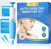 Liver Spot and Birthmark Remover