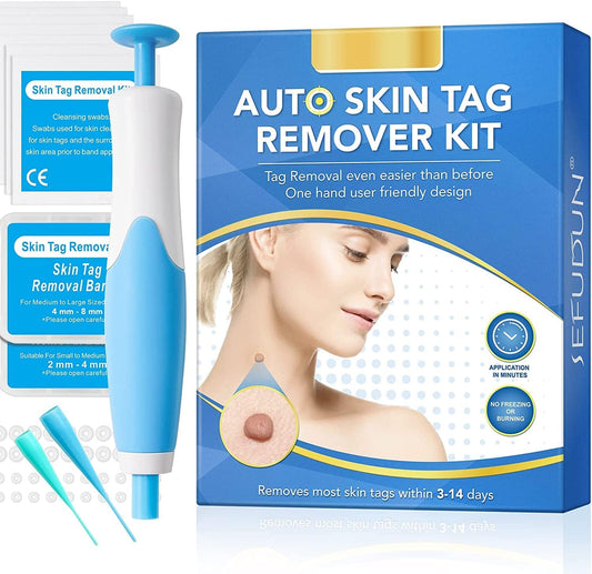 Liver Spot and Birthmark Remover