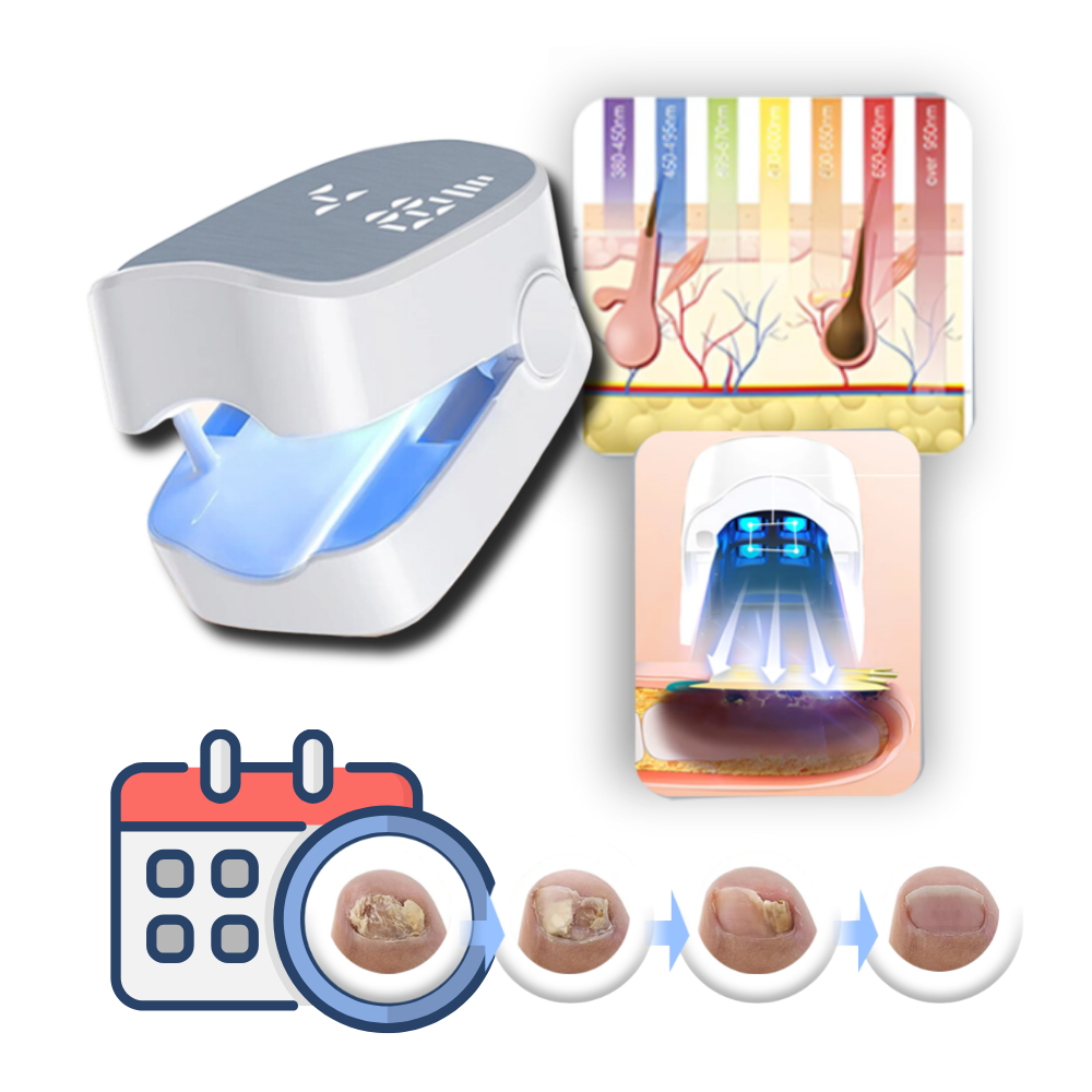 Painless Nail Fungus Laser Device