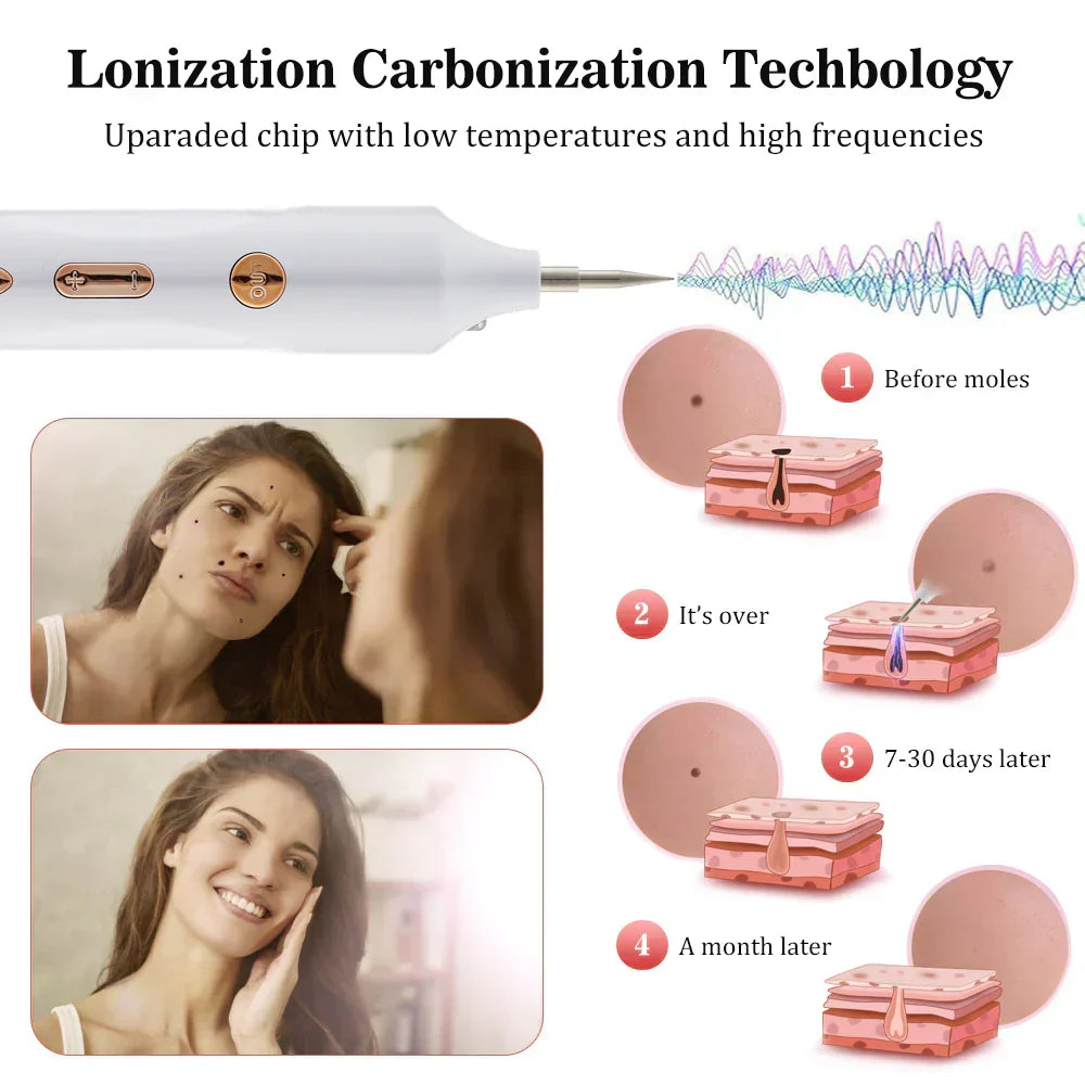 Plasma Pen Skin Tag Remover