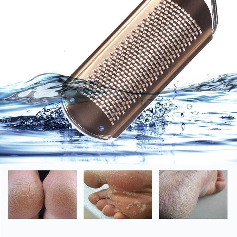 Professional Foot File Callus Remover