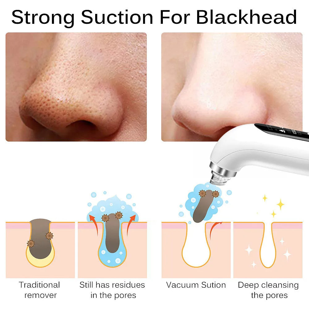 Professional Vacuum Nose Blackhead Remover - Deep Cleansing with Suction Technology