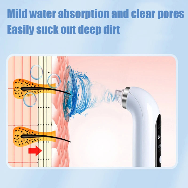 Professional Vacuum Nose Blackhead Remover - Deep Cleansing with Suction Technology