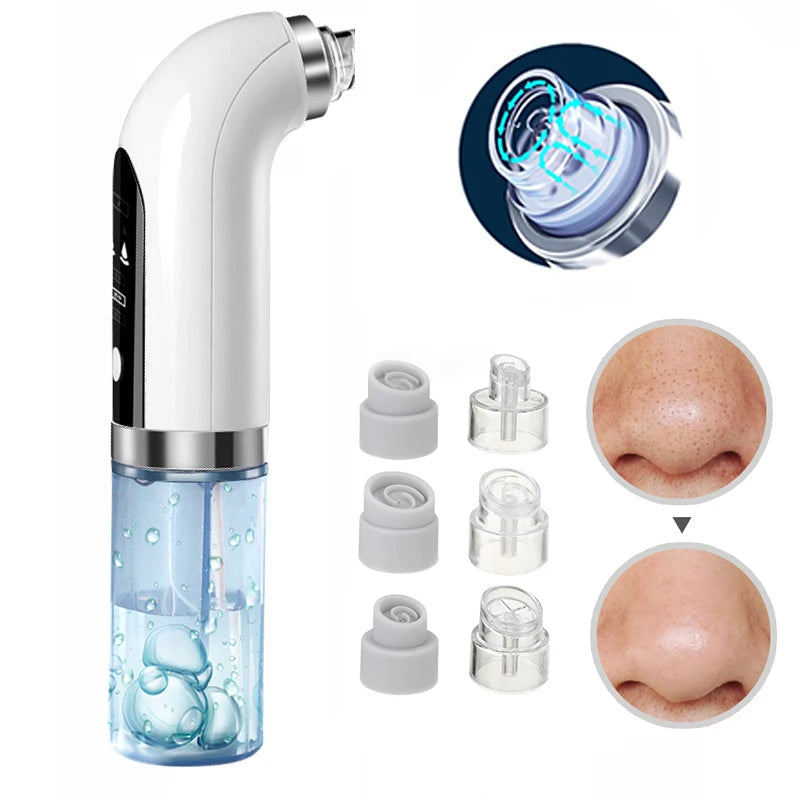 Professional Vacuum Nose Blackhead Remover - Deep Cleansing with Suction Technology